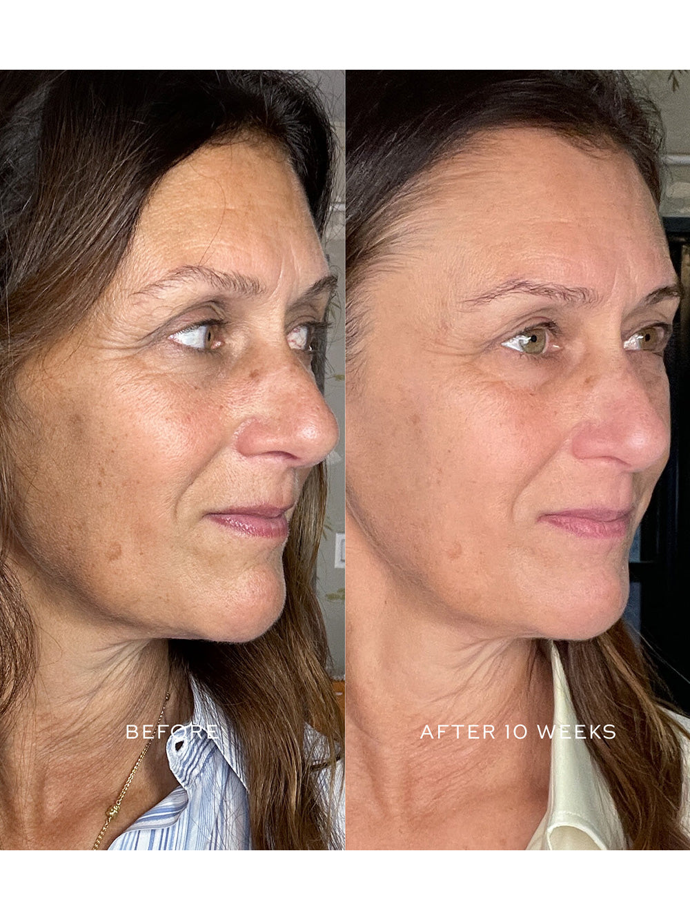 Suprême C Serum Refill