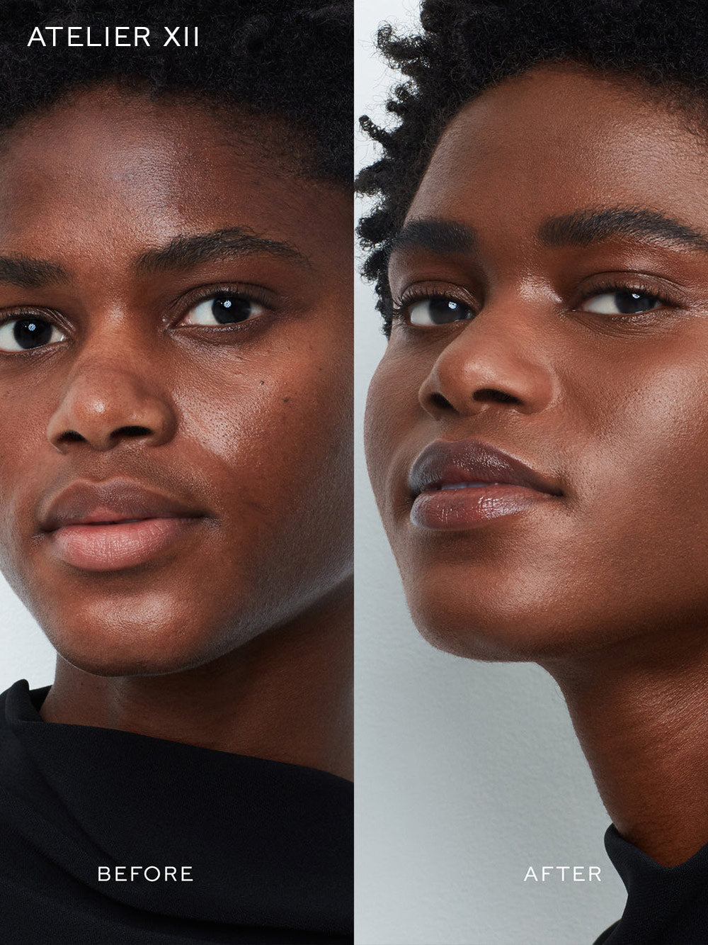 Vital Skincare Complexion Drops