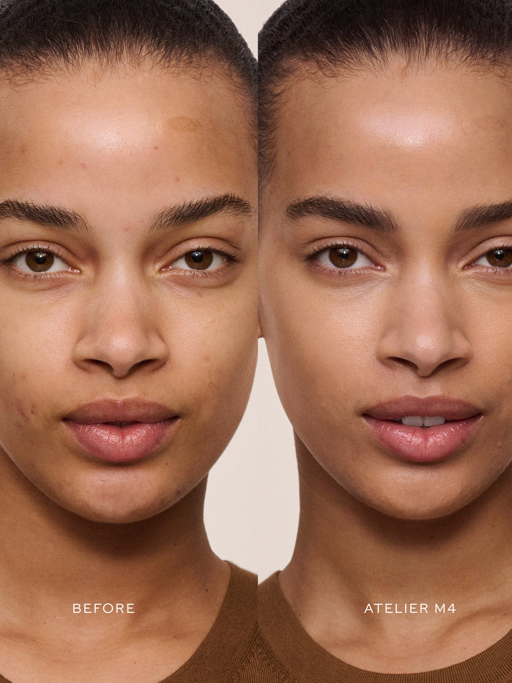 Vital Skincare Concealer