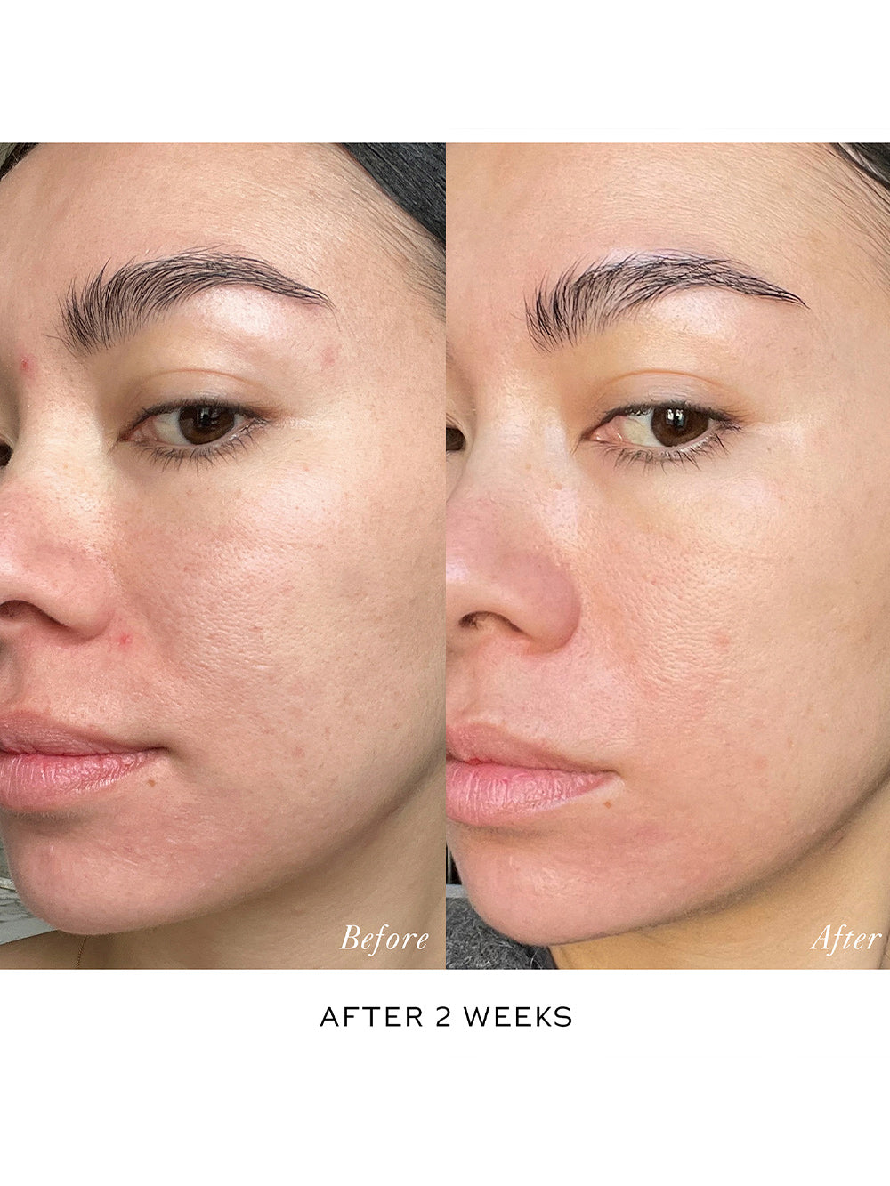 Skin Activator Serum