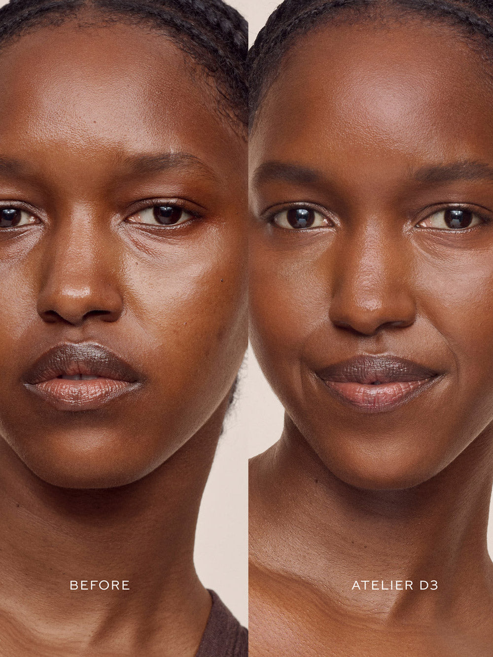 Vital Skincare Concealer